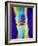 Coloured X-ray of a Human Knee Joint-Mehau Kulyk-Framed Photographic Print