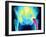 Coloured X-ray of An Artificial Hip Joint-Mehau Kulyk-Framed Photographic Print