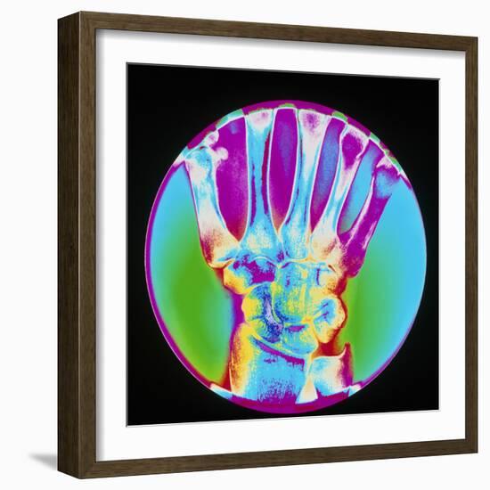 Coloured X-ray of Bones In the Wrist of the Hand-Mehau Kulyk-Framed Premium Photographic Print