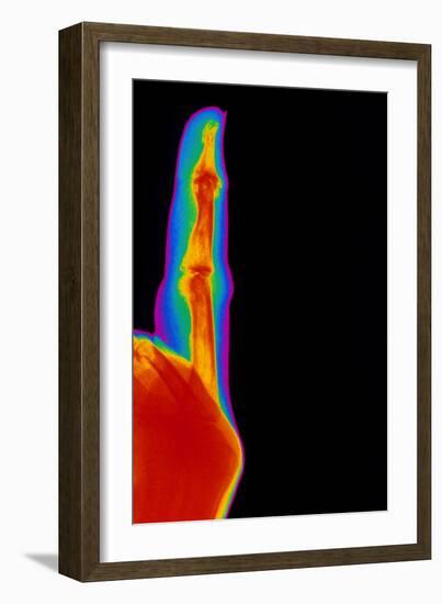 Coloured X-ray of Finger with Rheumatoid Arthritis-Mehau Kulyk-Framed Photographic Print