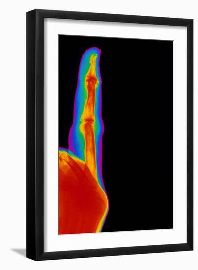Coloured X-ray of Finger with Rheumatoid Arthritis-Mehau Kulyk-Framed Photographic Print