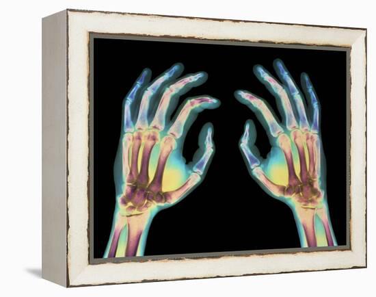 Coloured X-ray of Healthy Human Hands-Science Photo Library-Framed Premier Image Canvas