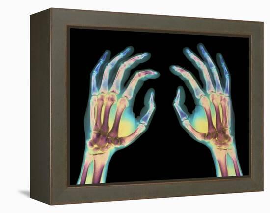 Coloured X-ray of Healthy Human Hands-Science Photo Library-Framed Premier Image Canvas