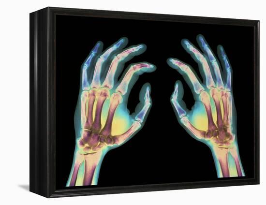 Coloured X-ray of Healthy Human Hands-Science Photo Library-Framed Premier Image Canvas