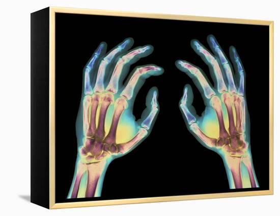 Coloured X-ray of Healthy Human Hands-Science Photo Library-Framed Premier Image Canvas