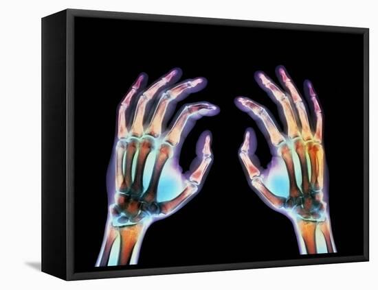 Coloured X-ray of Healthy Human Hands-Science Photo Library-Framed Premier Image Canvas