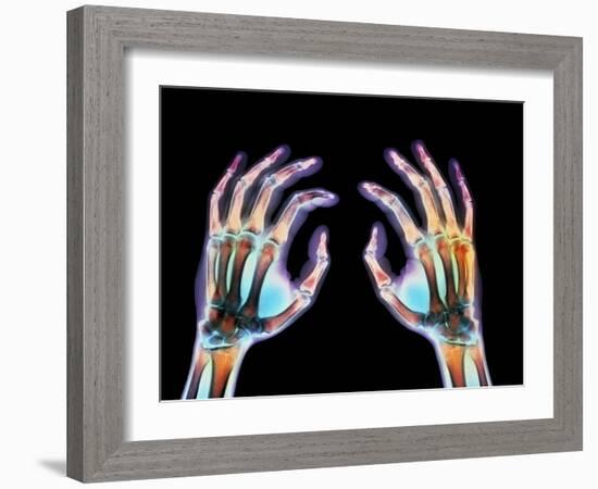 Coloured X-ray of Healthy Human Hands-Science Photo Library-Framed Photographic Print