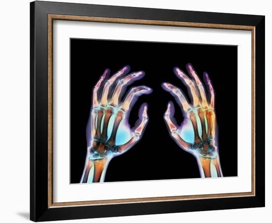 Coloured X-ray of Healthy Human Hands-Science Photo Library-Framed Photographic Print