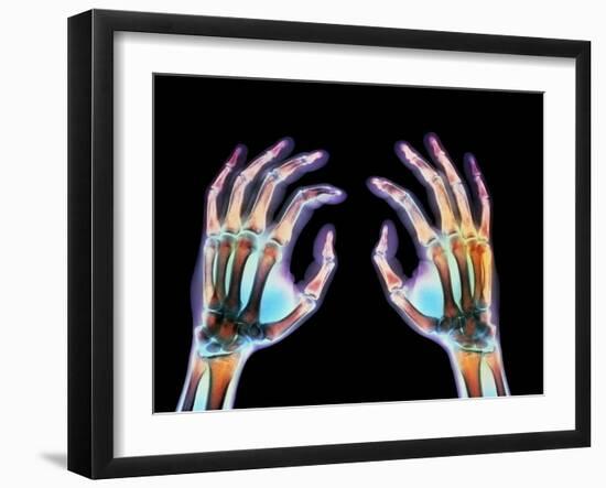 Coloured X-ray of Healthy Human Hands-Science Photo Library-Framed Photographic Print