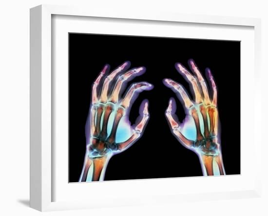 Coloured X-ray of Healthy Human Hands-Science Photo Library-Framed Photographic Print