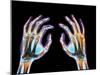 Coloured X-ray of Healthy Human Hands-Science Photo Library-Mounted Photographic Print