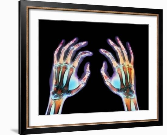 Coloured X-ray of Healthy Human Hands-Science Photo Library-Framed Photographic Print