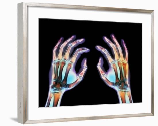 Coloured X-ray of Healthy Human Hands-Science Photo Library-Framed Photographic Print