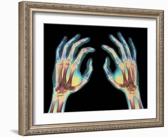 Coloured X-ray of Healthy Human Hands-Science Photo Library-Framed Photographic Print