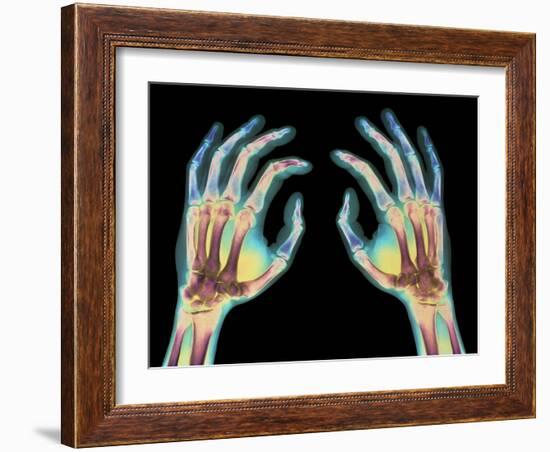 Coloured X-ray of Healthy Human Hands-Science Photo Library-Framed Photographic Print