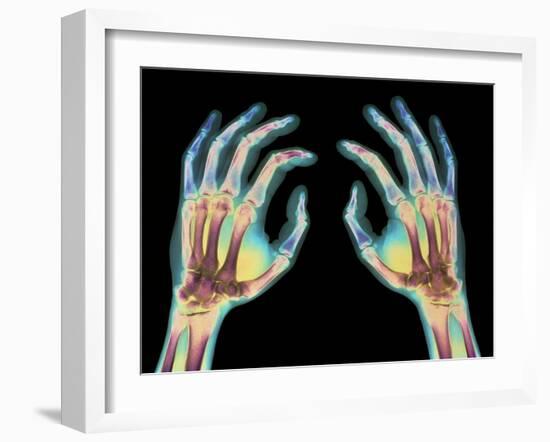 Coloured X-ray of Healthy Human Hands-Science Photo Library-Framed Photographic Print