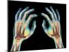 Coloured X-ray of Healthy Human Hands-Science Photo Library-Mounted Photographic Print