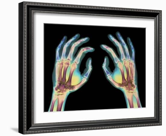 Coloured X-ray of Healthy Human Hands-Science Photo Library-Framed Photographic Print