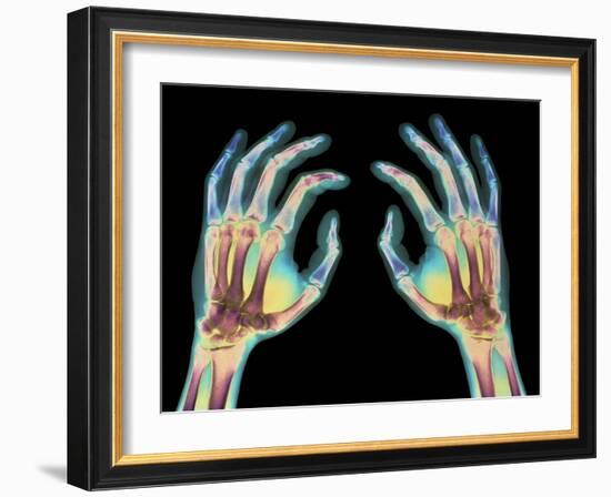 Coloured X-ray of Healthy Human Hands-Science Photo Library-Framed Photographic Print