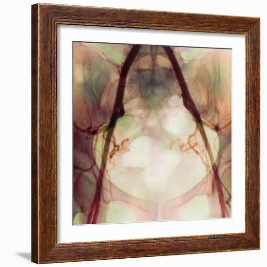 Coloured X-ray of Iliac Arteries To the Pelvis-Science Photo Library-Framed Premium Photographic Print