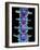 Coloured X-ray of Lumbar Vertebrae of the Spine-Science Photo Library-Framed Photographic Print