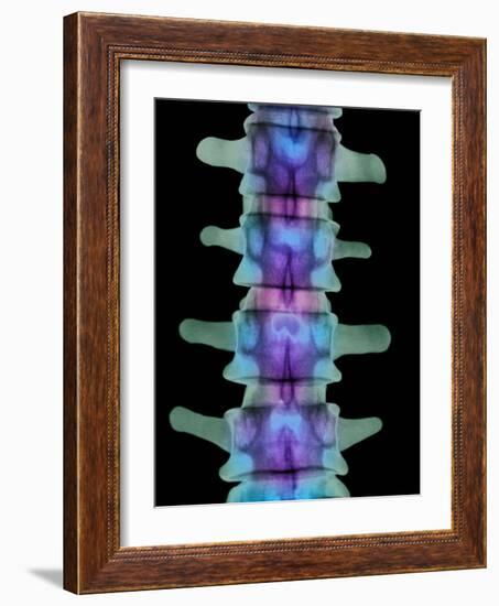 Coloured X-ray of Lumbar Vertebrae of the Spine-Science Photo Library-Framed Photographic Print