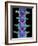 Coloured X-ray of Lumbar Vertebrae of the Spine-Science Photo Library-Framed Photographic Print