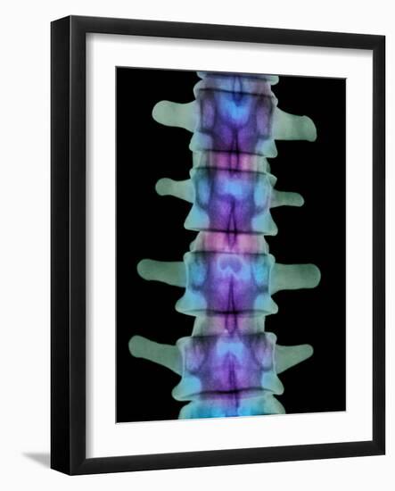 Coloured X-ray of Lumbar Vertebrae of the Spine-Science Photo Library-Framed Photographic Print