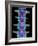 Coloured X-ray of Lumbar Vertebrae of the Spine-Science Photo Library-Framed Photographic Print