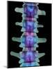 Coloured X-ray of Lumbar Vertebrae of the Spine-Science Photo Library-Mounted Photographic Print