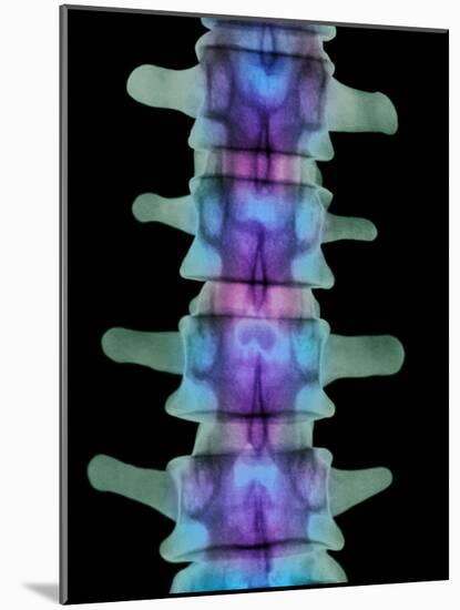 Coloured X-ray of Lumbar Vertebrae of the Spine-Science Photo Library-Mounted Photographic Print