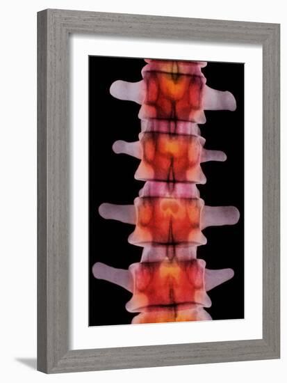 Coloured X-ray of Lumbar Vertebrae of The-Science Photo Library-Framed Photographic Print