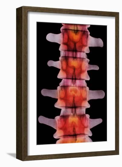 Coloured X-ray of Lumbar Vertebrae of The-Science Photo Library-Framed Photographic Print