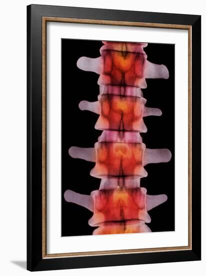 Coloured X-ray of Lumbar Vertebrae of The-Science Photo Library-Framed Photographic Print