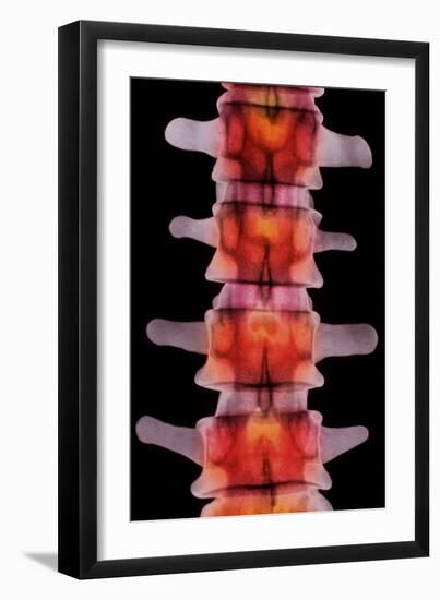 Coloured X-ray of Lumbar Vertebrae of The-Science Photo Library-Framed Photographic Print