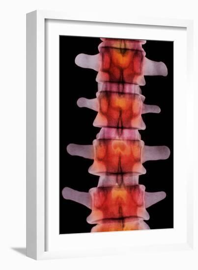 Coloured X-ray of Lumbar Vertebrae of The-Science Photo Library-Framed Photographic Print