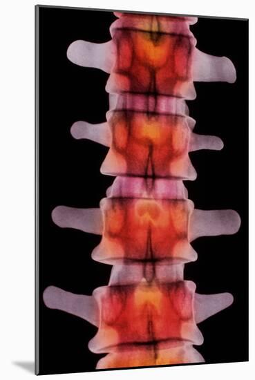 Coloured X-ray of Lumbar Vertebrae of The-Science Photo Library-Mounted Photographic Print