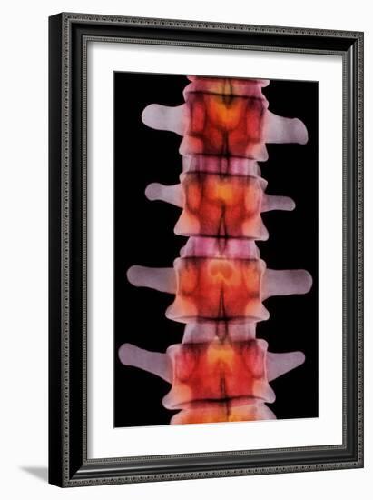 Coloured X-ray of Lumbar Vertebrae of The-Science Photo Library-Framed Photographic Print