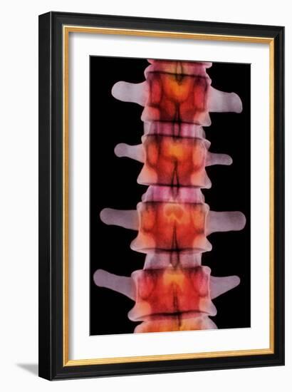 Coloured X-ray of Lumbar Vertebrae of The-Science Photo Library-Framed Photographic Print