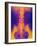 Coloured X-ray of Normal Lower Spine And Pelvis-Mehau Kulyk-Framed Photographic Print