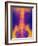 Coloured X-ray of Normal Lower Spine And Pelvis-Mehau Kulyk-Framed Photographic Print