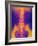 Coloured X-ray of Normal Lower Spine And Pelvis-Mehau Kulyk-Framed Photographic Print