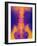 Coloured X-ray of Normal Lower Spine And Pelvis-Mehau Kulyk-Framed Photographic Print