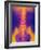 Coloured X-ray of Normal Lower Spine And Pelvis-Mehau Kulyk-Framed Photographic Print