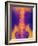 Coloured X-ray of Normal Lower Spine And Pelvis-Mehau Kulyk-Framed Photographic Print