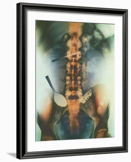 Coloured X-ray of Spoon And Blade In Intestine-Science Photo Library-Framed Photographic Print