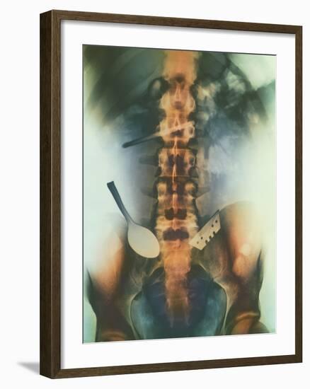 Coloured X-ray of Spoon And Blade In Intestine-Science Photo Library-Framed Photographic Print