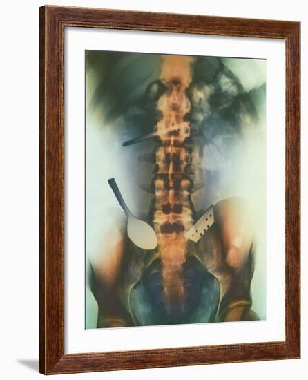 Coloured X-ray of Spoon And Blade In Intestine-Science Photo Library-Framed Photographic Print