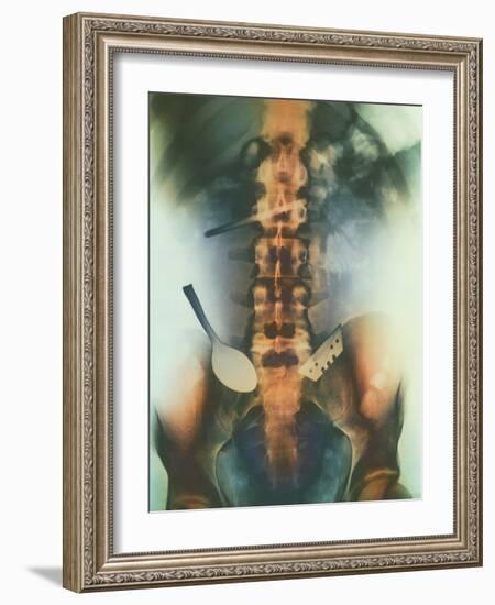 Coloured X-ray of Spoon And Blade In Intestine-Science Photo Library-Framed Photographic Print