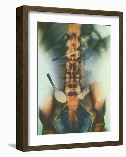 Coloured X-ray of Spoon And Blade In Intestine-Science Photo Library-Framed Photographic Print
